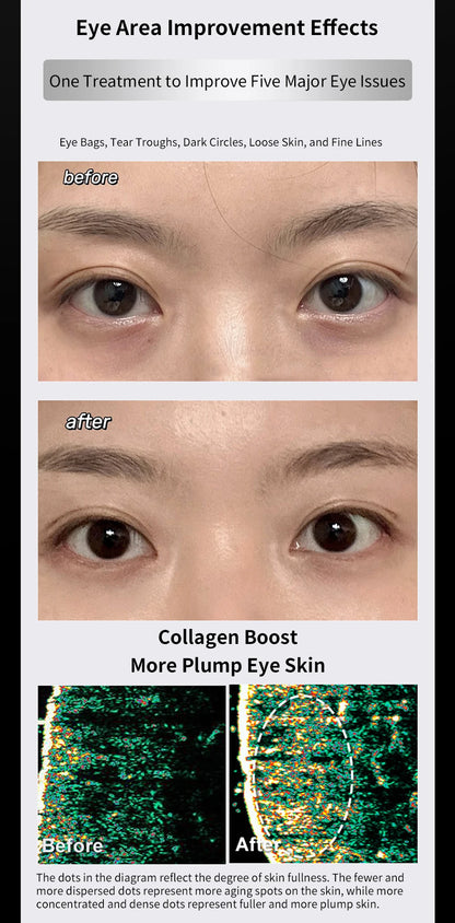 Ems Pulse Microcurrent Eye Care Device Eye Massager To Relieve Fatigue Massage Reduce Dark Circles Eye Swelling Anti-Wrinkle