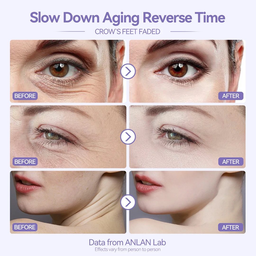 ANLAN EMS Facial Massager Face Lifting LED Photon Deep Cleaning Eye Skin Wrinkle Removing Heat Vibration Skincare Beauty Device