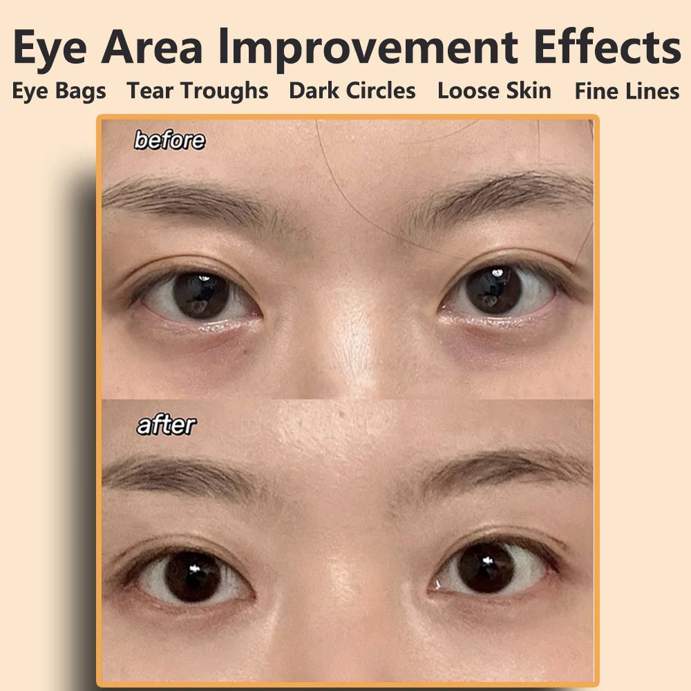 Ems Pulse Microcurrent Eye Care Device Eye Massager To Relieve Fatigue Massage Reduce Dark Circles Eye Swelling Anti-Wrinkle