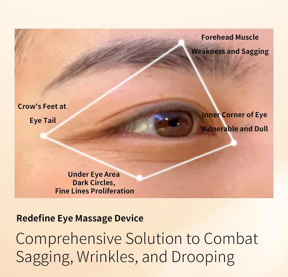 Ems Pulse Microcurrent Eye Care Device Eye Massager To Relieve Fatigue Massage Reduce Dark Circles Eye Swelling Anti-Wrinkle