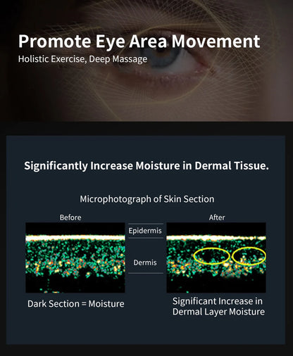 Ems Pulse Microcurrent Eye Care Device Eye Massager To Relieve Fatigue Massage Reduce Dark Circles Eye Swelling Anti-Wrinkle